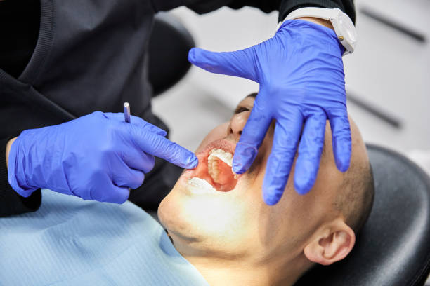 Best Emergency Dental Care for Trauma or Injury in Montgomery, PA